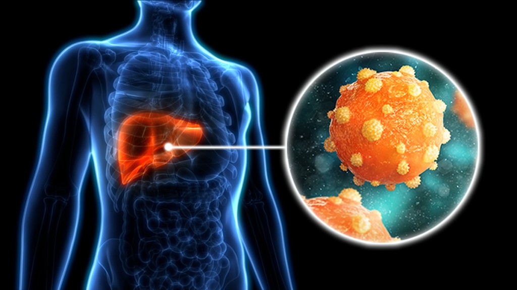 New Hepatitis B Vaccine Study Suggests A Few Hundred More Cases of HepB Chronic Infection if Day of Birth Vaccine is Dropped